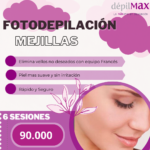 Mejillas